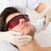 Hair removal by laser